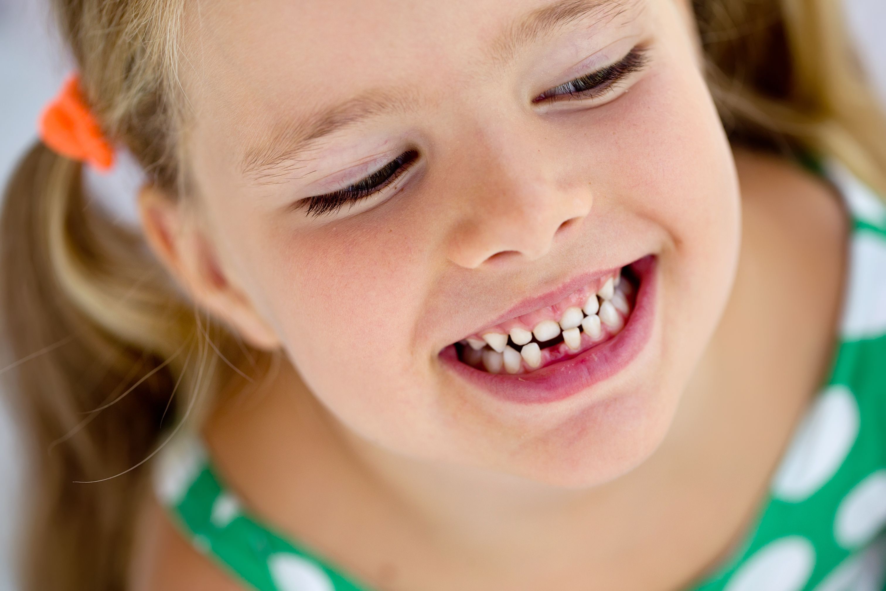 Young girl smiling with missing tooth