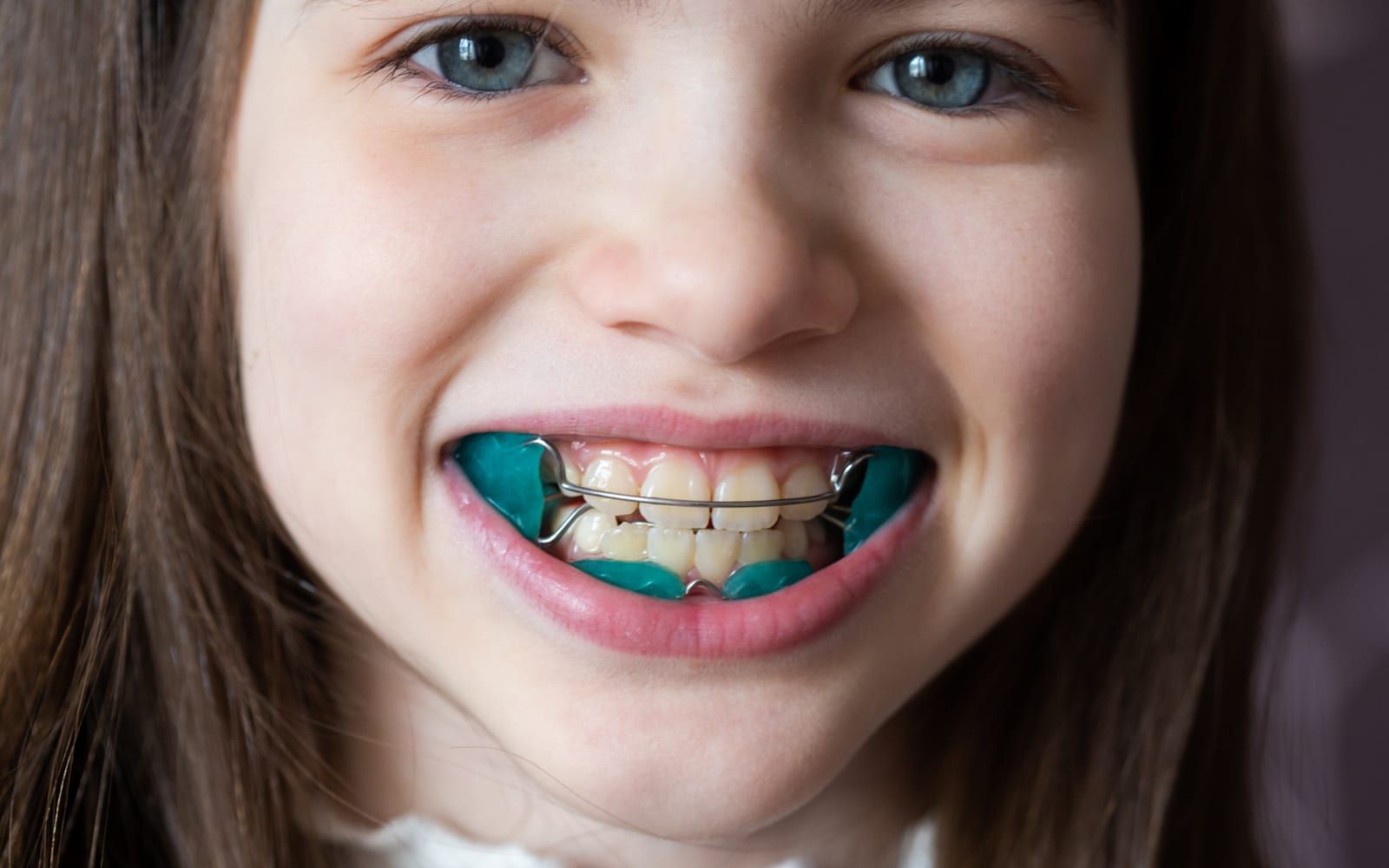 Child With Orthodontics