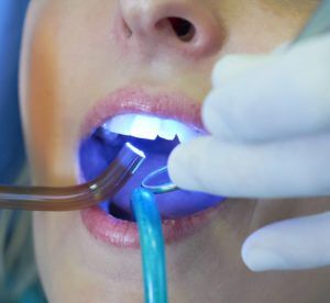 dental exam with blue light