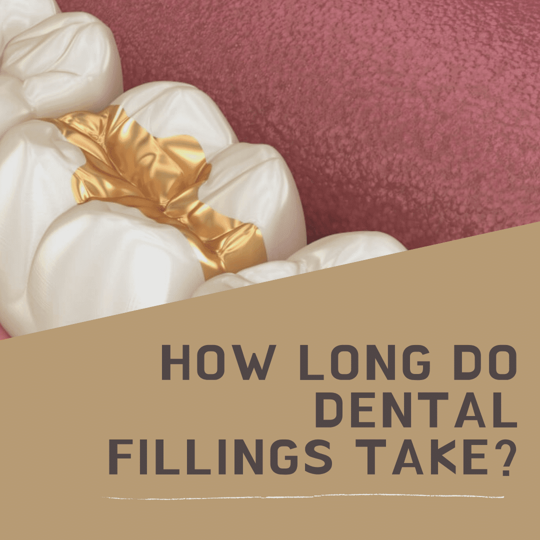 How Long Do Dental Fillings Take?