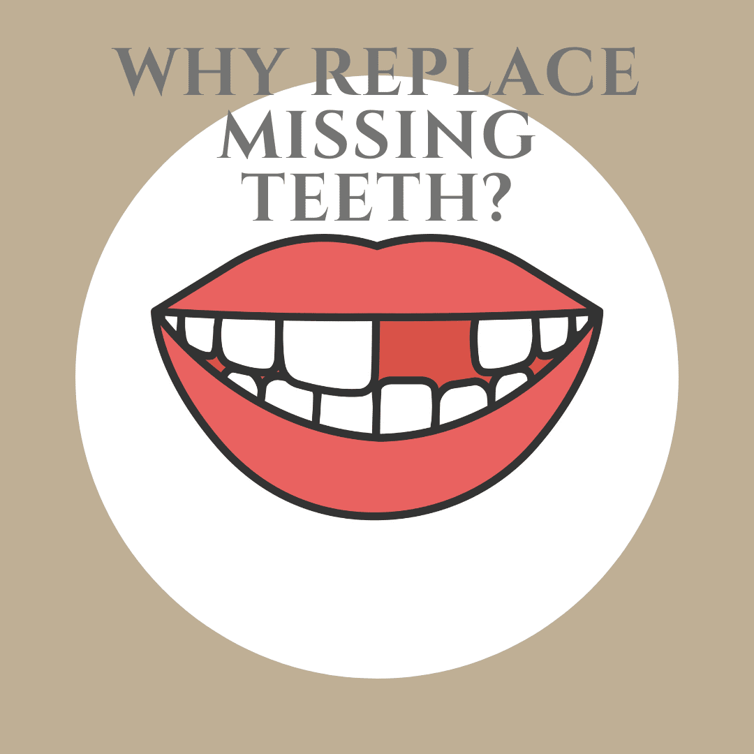 Why Replace Missing Teeth