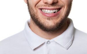 Man with Missing Teeth