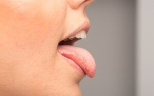 Side Profile of Tongue