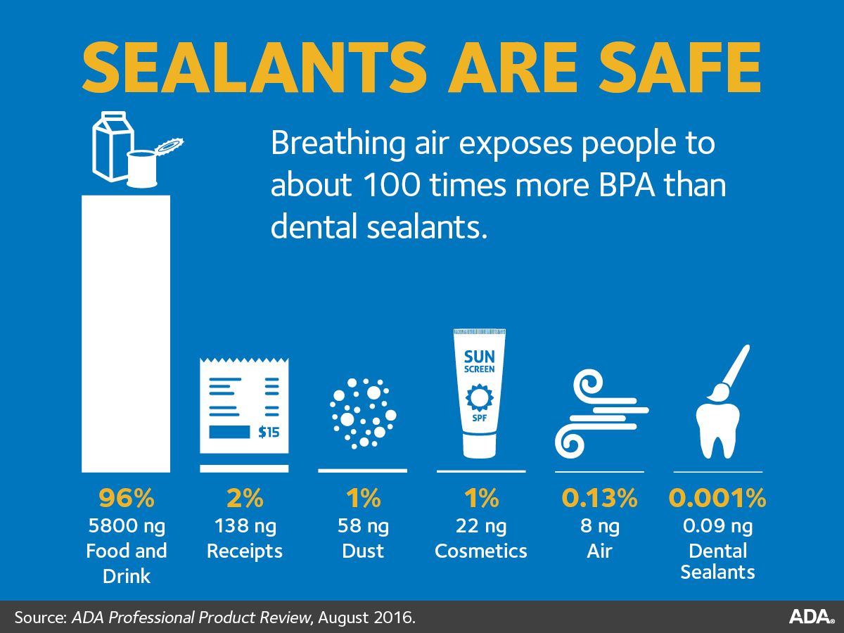 ADA Chart--dental sealants are safe
