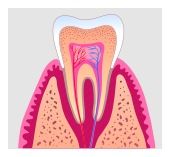 root canal treatment in Torrance