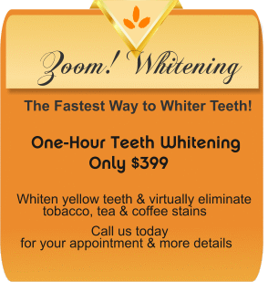 Zoom! Whitening Special in San Jose