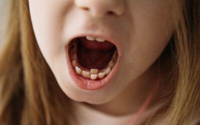 Why Do Adult Teeth Come in Behind My Child’s Baby Teeth?