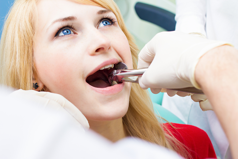 Tooth-Extraction